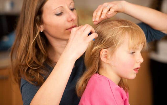 head lice treatment Beach Kids Pediatrics